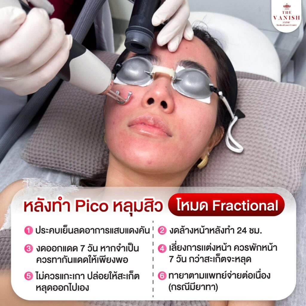 คำแนะนำจากแพทย์หลังทำ PicoWay Laser