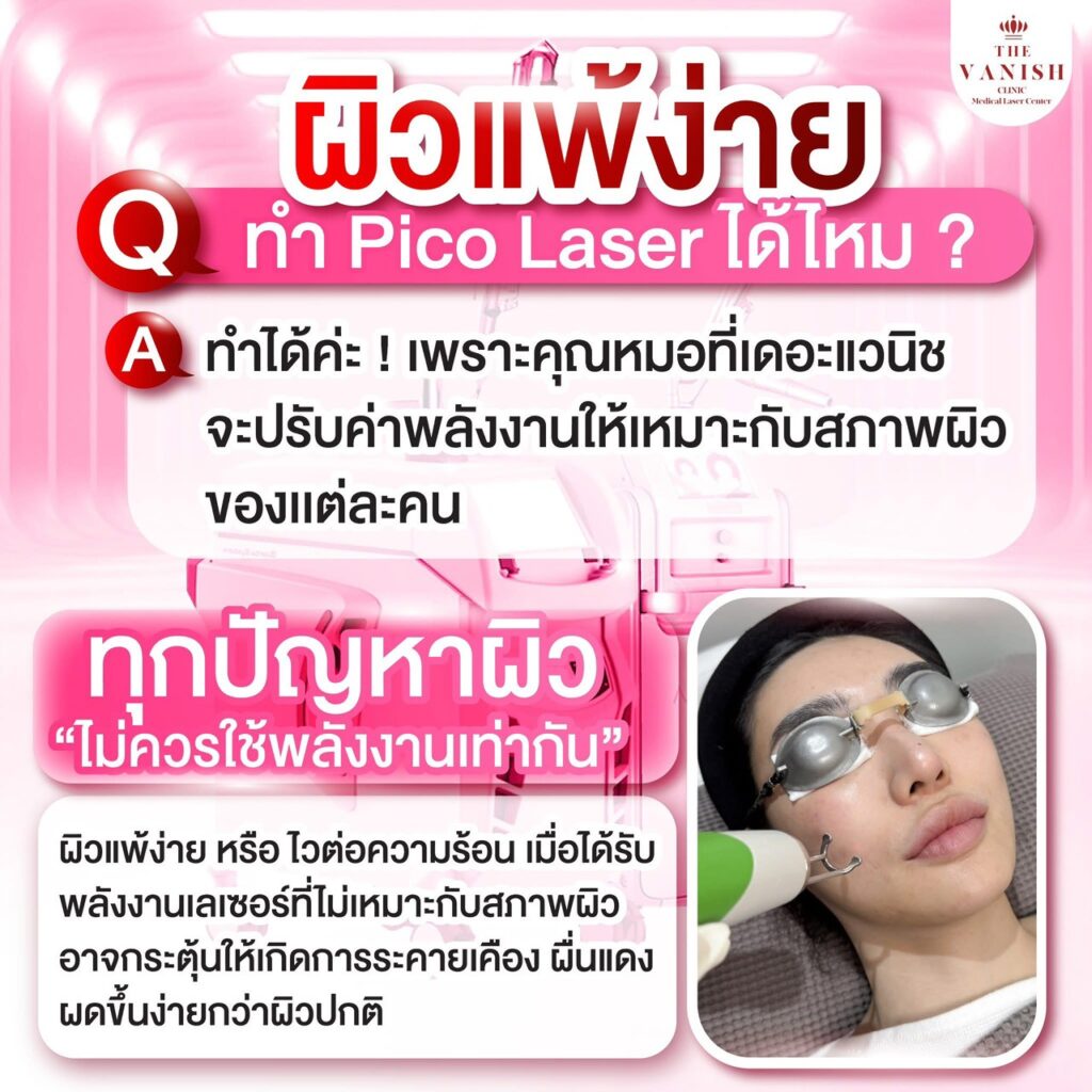 คำถามที่พบบ่อย ผิวแพ้ง่าย PicoWay Laser ได้ไหม
