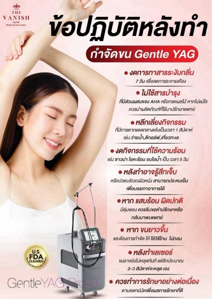 ข้อปฎิบัติหลังทำหัตถการกำจัดขน Gentle Yag