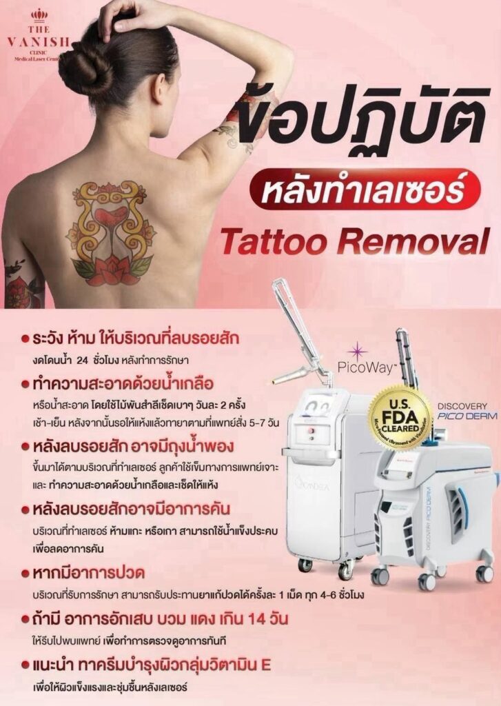 ข้อปฎิบัติหลังทำเลเซอร์ Tattoo Removal