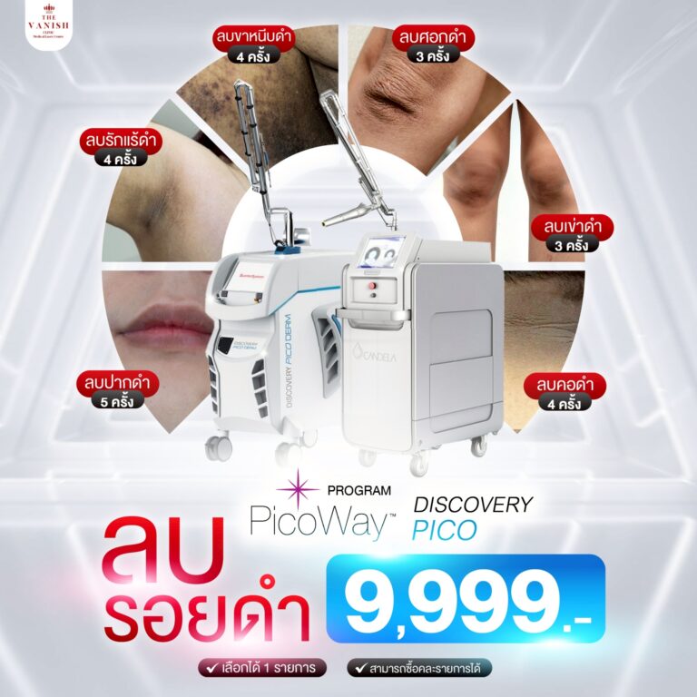 Aw4