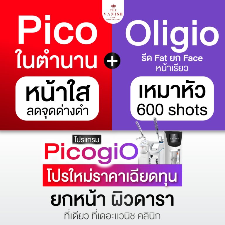 S__11927672_0