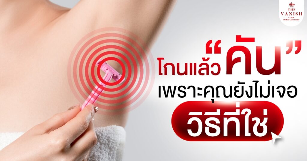 หยุดปัญหาโกนขนแล้วคัน บอกลาความยุบยิบ ทำยังไง?