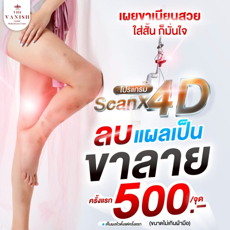 ขาลาย-02-01_0