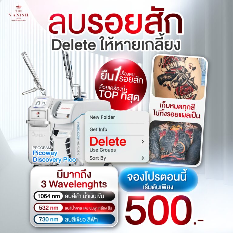 ลบรอยสัก11_0
