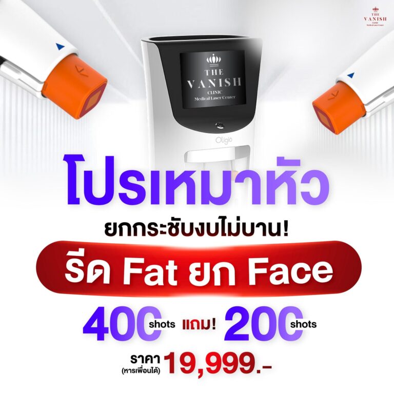 เครื่องoligio(web)