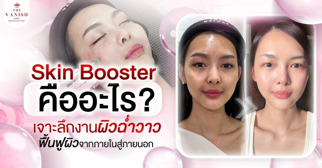 Skin Booster คืออะไร? เจาะลึกงานผิวฉ่ำวาว ฟื้นฟูผิวจากภายในสู่ภายนอก