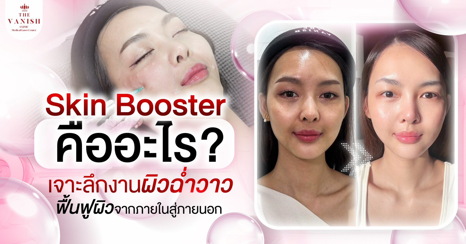 Skin Booster คืออะไร? เจาะลึกงานผิวฉ่ำวาว ฟื้นฟูผิวจากภายในสู่ภายนอก