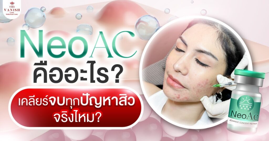 สิวครบ จบด้วย NeoAc นวัตกรรมเพื่อผิวแข็งแรงและกระจ่างใส