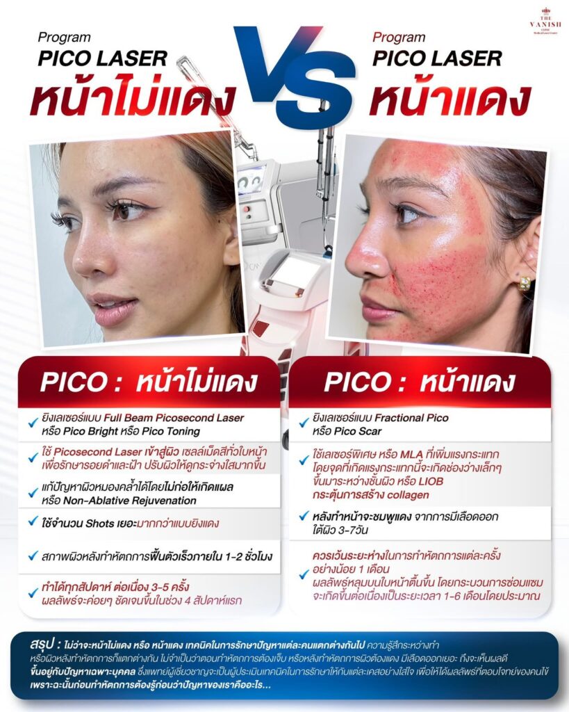Pico Laser หน้าแดงกับไม่หน้าแดงต่างกันอย่างไร
