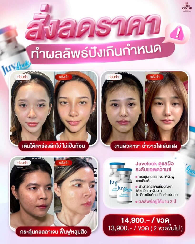 โปรโมชั่น Skin Booster ตัวดัง Juvelook อัพเดท ปี 2569 จาก The Vanish Clinic