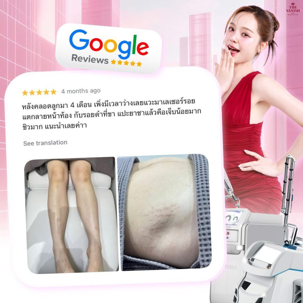 รีวิวจริงจาก Google Review ของคนไข้ The Vanish Clinic