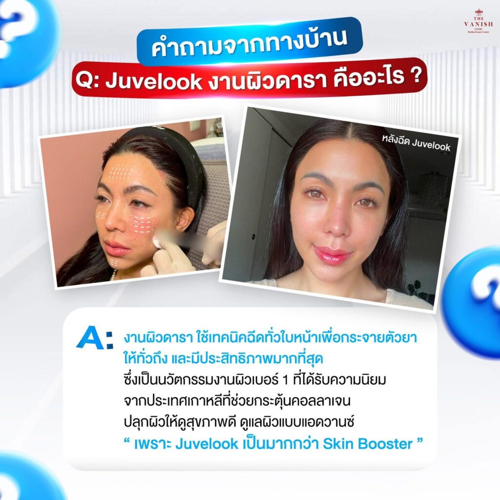 Juvelook งานผิวดารา คืออะไร?