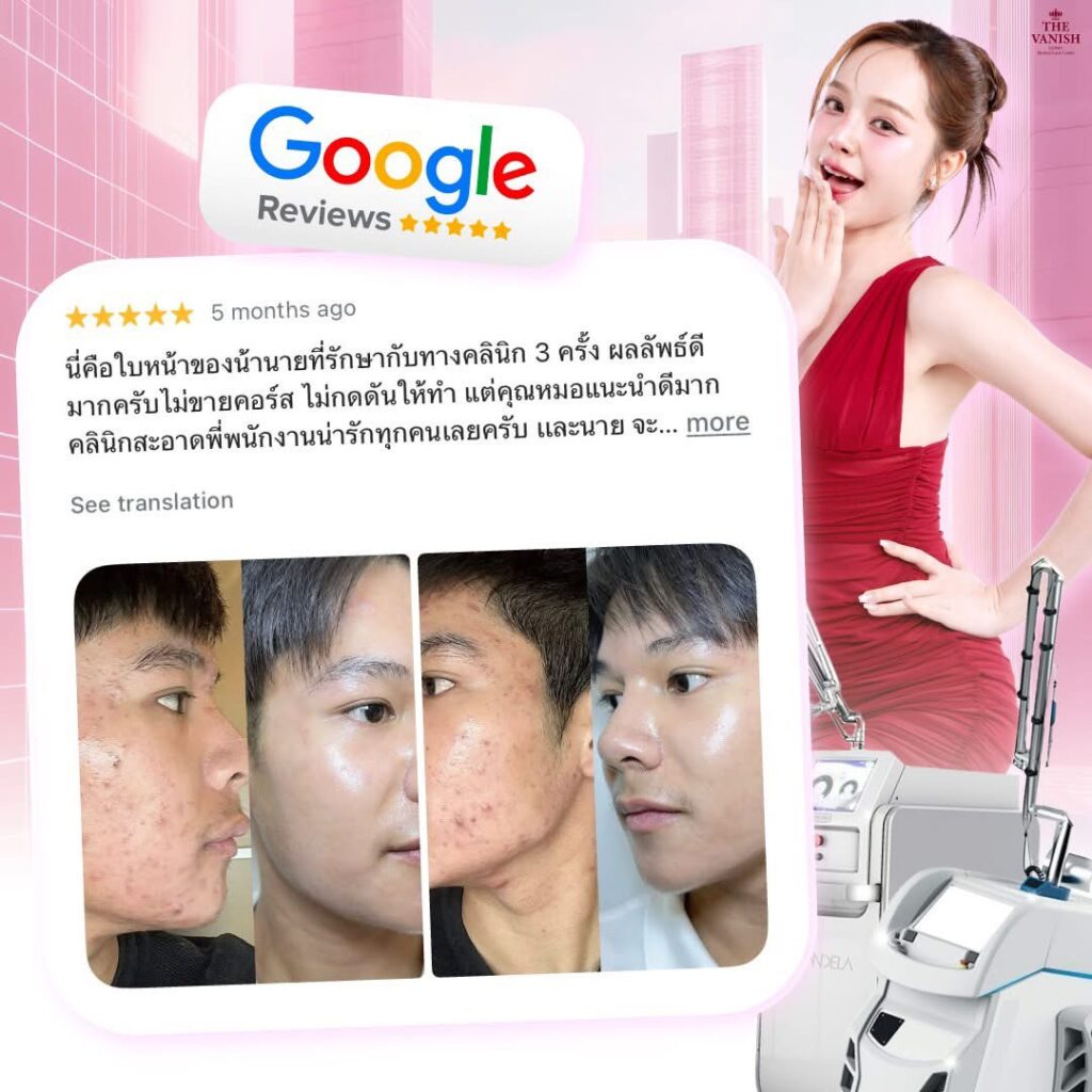 รีวิวจริงจาก Google Review ของคนไข้ The Vanish Clinic
