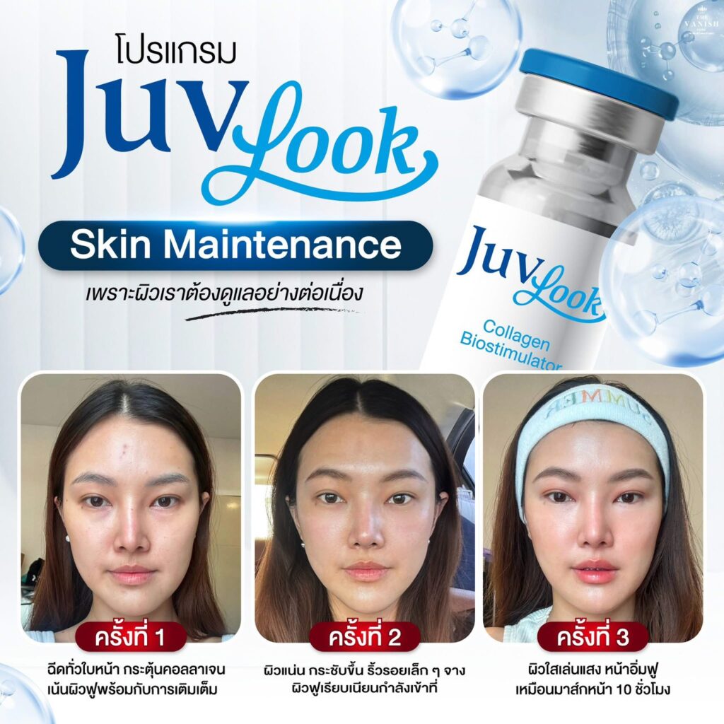 ผลลัพธืการทำ Juvelook ที่ The Vanish Clinic ครั้งที่ 1/2/3