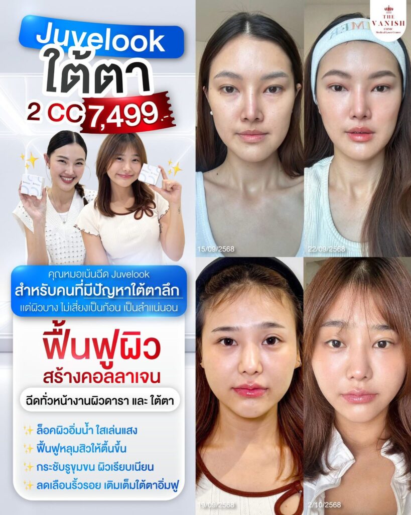 โปรโมชั่น Skin Booster ตัวดัง Juvelook อัพเดท ปี 2569 จาก The Vanish Clinic