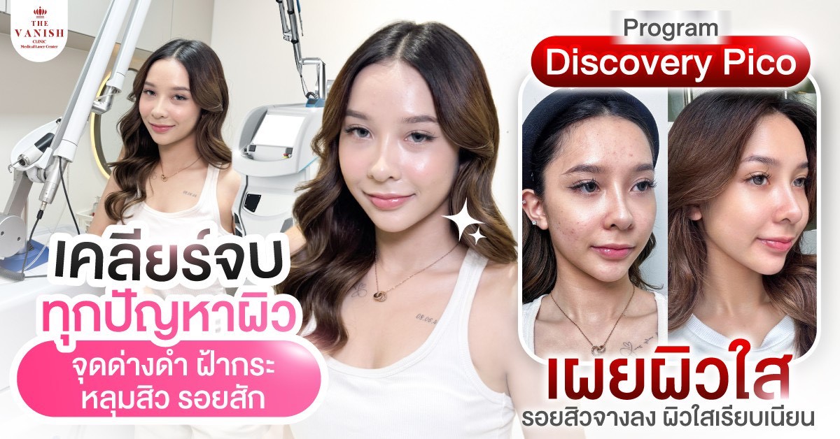 Discovery Pico Laser คืออะไร? เคลียร์จบทุกปัญหาผิวได้จริงไหม
