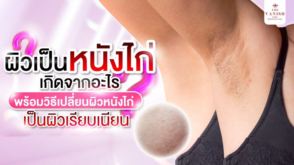 วิธีจัดการผิวเป็นหนังไก่ ผิวขรุขระให้กลับมาเรียบเนียน