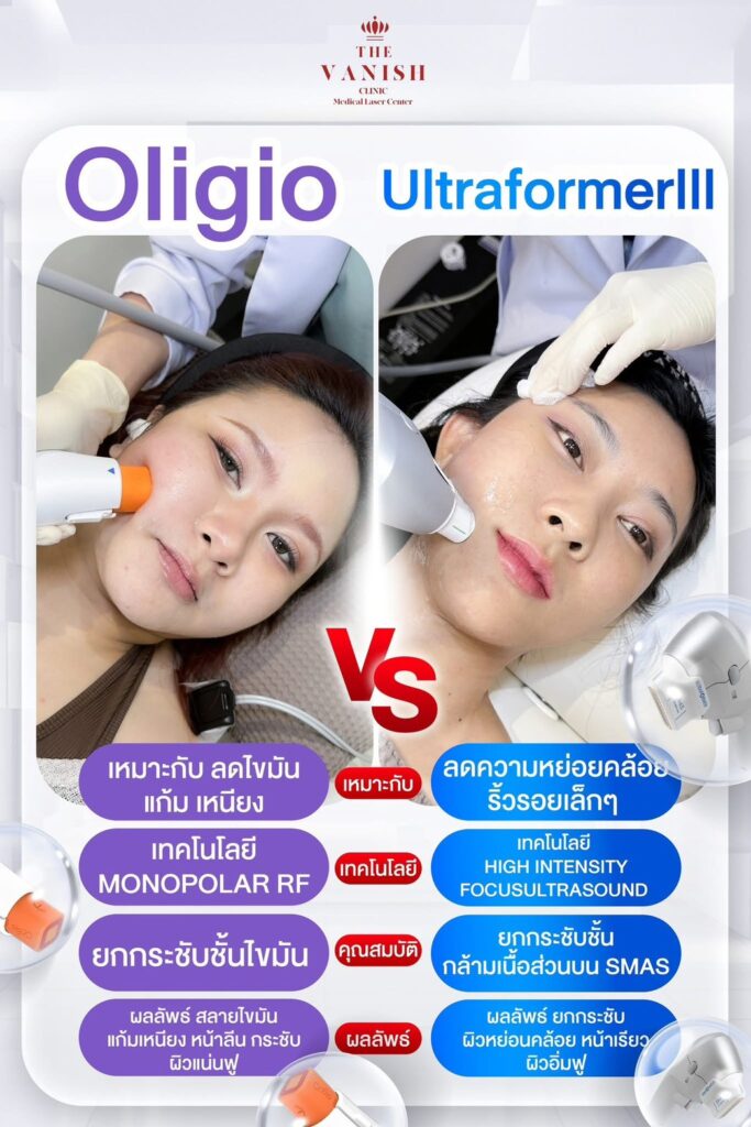 ตารางเปรียบเทียบ Oligio vs Ultraformer