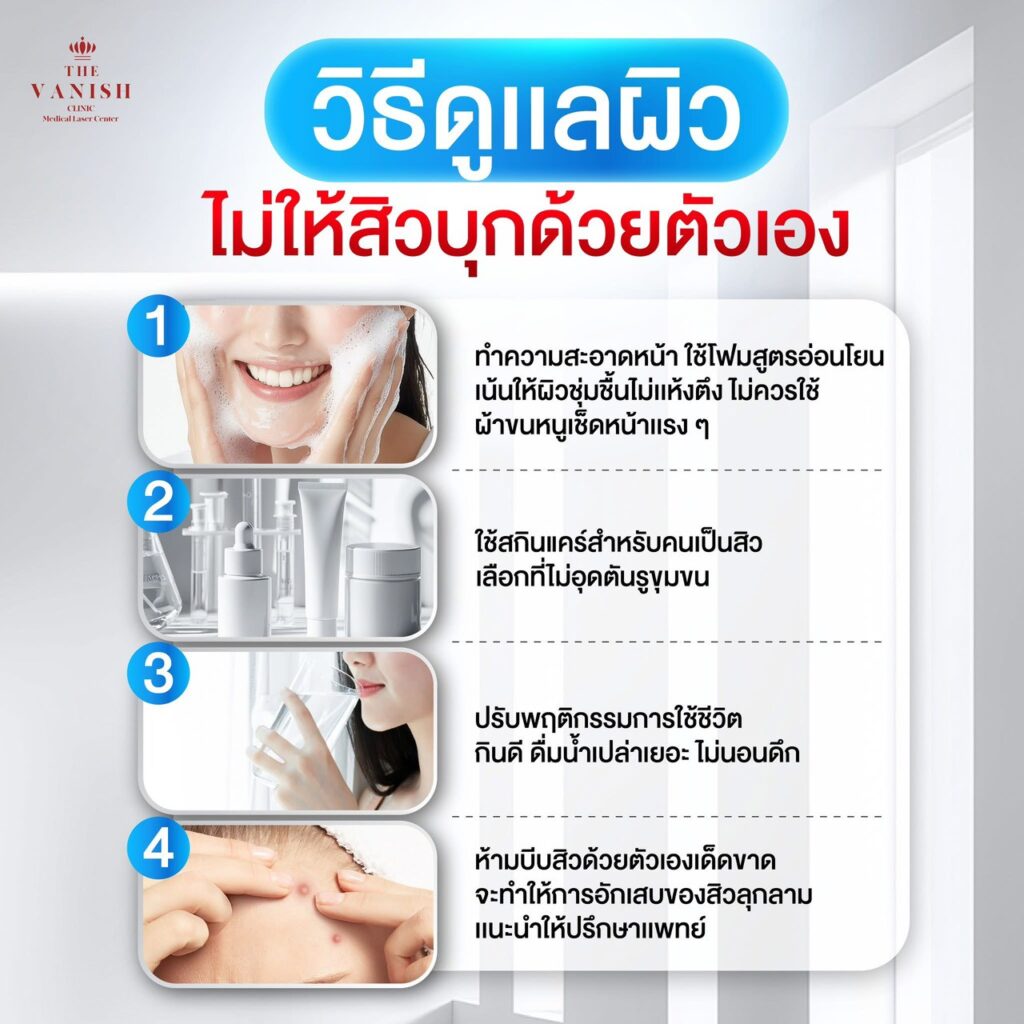 สิวอักเสบหัวหนอง รักษาได้ด้วยวิธีไหนบ้าง