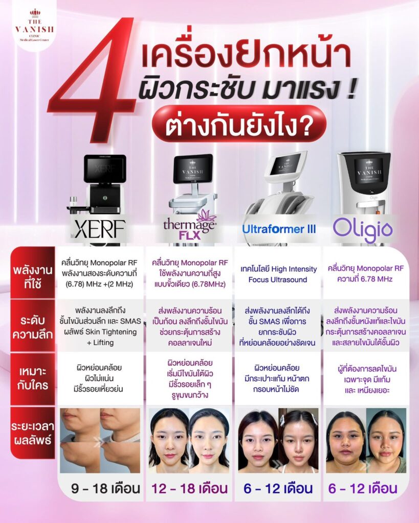เปรียบเทียบ ยกกระชับหน้า วิธีไหนดีที่สุด