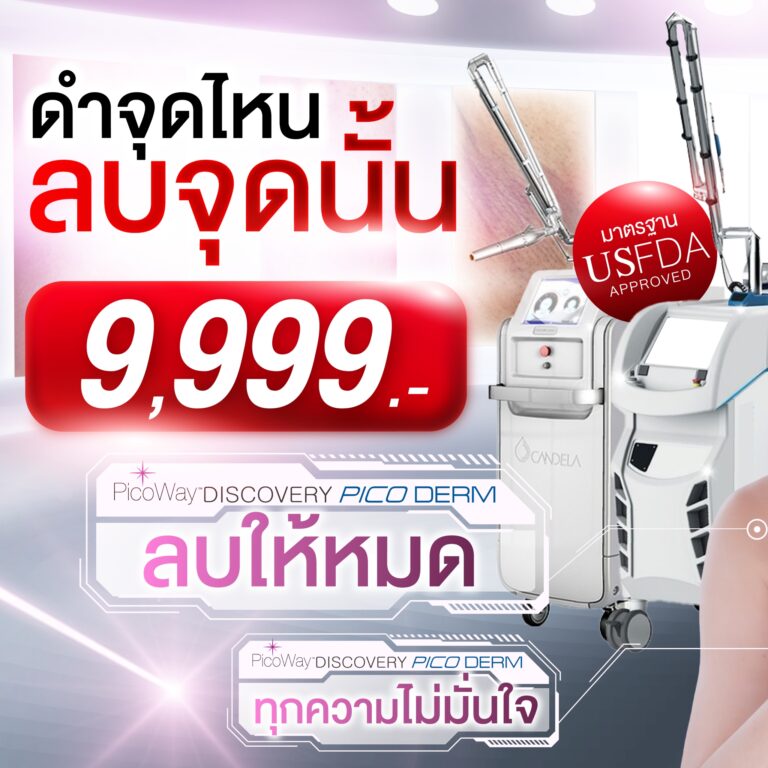 โปร-01_0