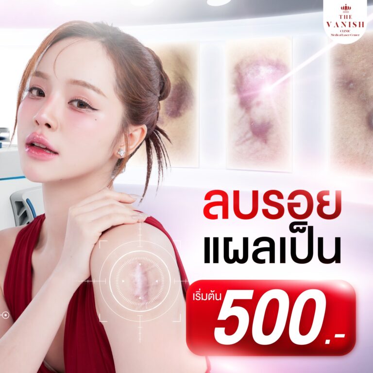โปร-02_0
