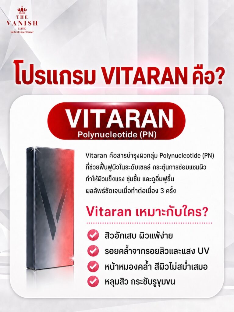 โปรแกรม Vitaran คืออะไร?