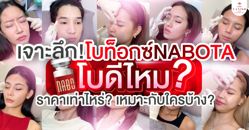เจาะลึก โบท็อกซ์นาโบตะ (Botox Nabota) โบดีไหม ราคาเท่าไหร่ เหมาะกับใครบ้าง